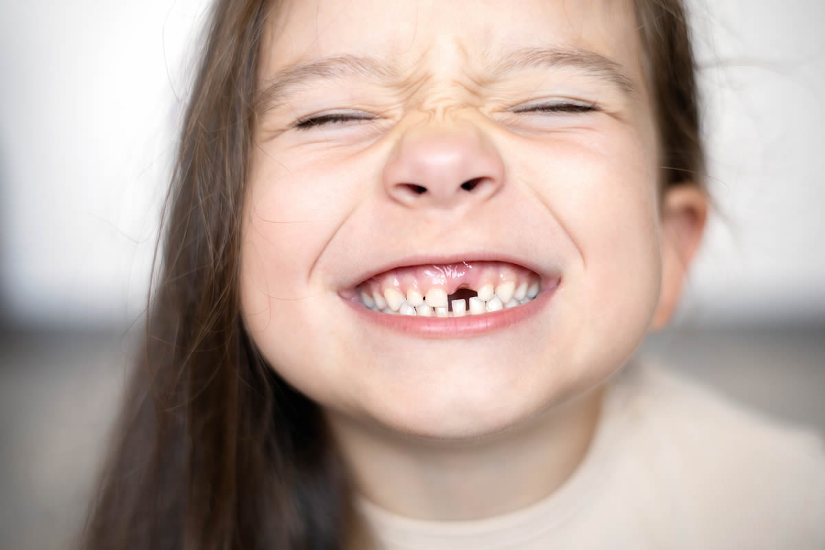 dientes de leche